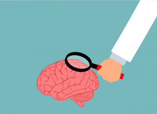 мозак-преглед-неуролог