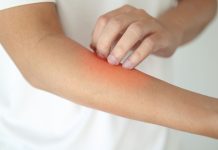 Зашто кожа остаје сува и када је редовно мажете