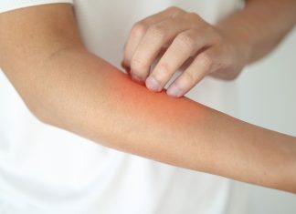 Зашто кожа остаје сува и када је редовно мажете