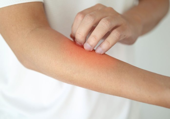 suva i upaljena koža