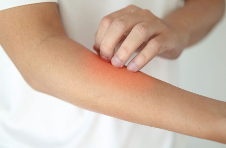 Зашто кожа остаје сува и када је редовно мажете